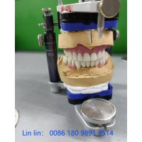 深圳义齿外贸厂家以3D打印与数字化扫描技术提升产品精度与美观
